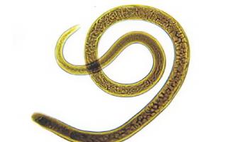 Аскариды: размеры и как выглядят круглые черви?