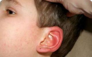 О чем говорит шелушение кожи в ушах: когда нужно начинать беспокоиться
