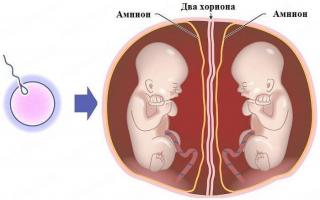 Особенности многоплодной беременности 13 неделя беременности двойней что происходит