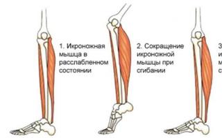 Почему сводит икры ног по ночам (утрам) — что делать при судорогах в икроножных мышцах?